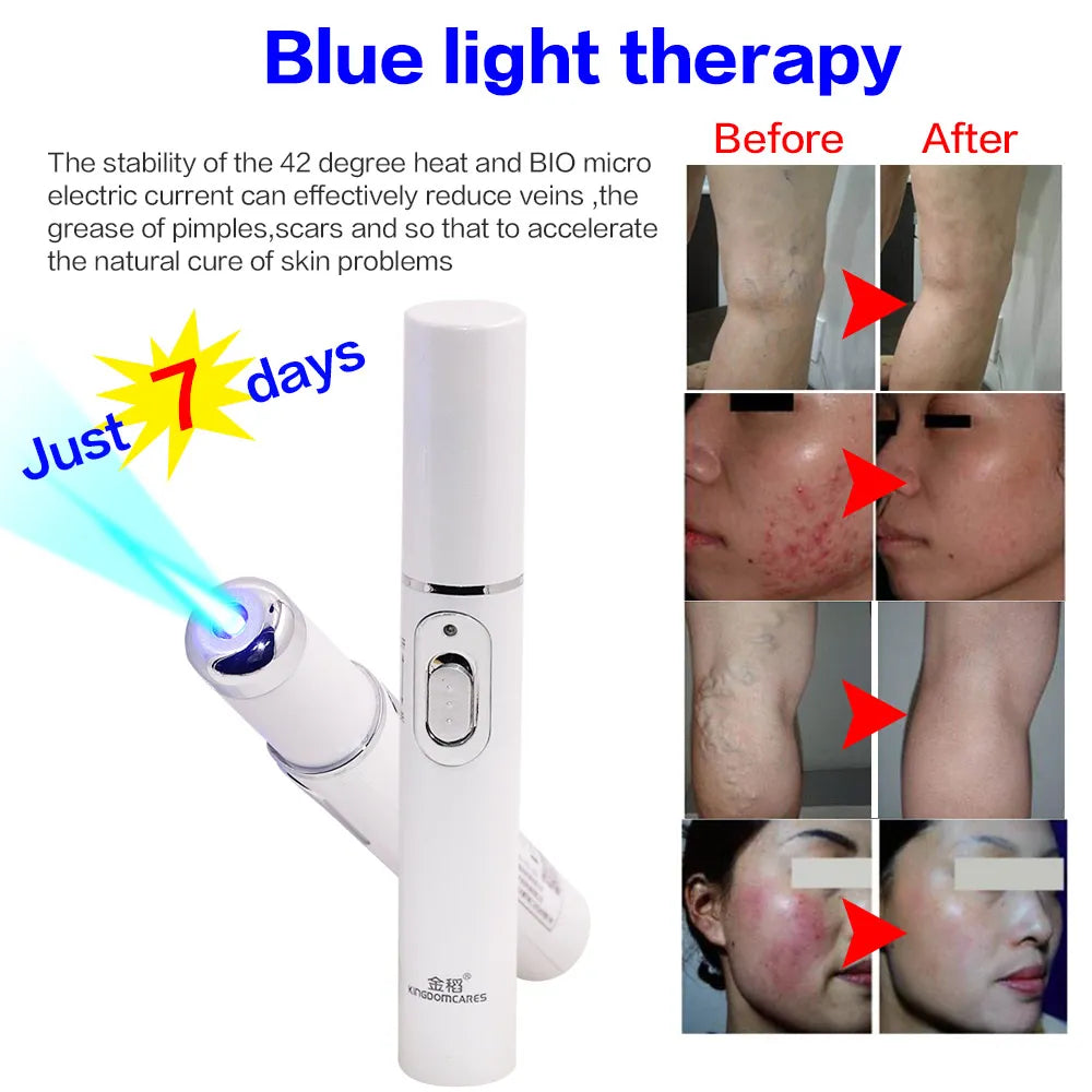 Appareil de beauté à lumière bleue pour le visage, élimination des rides et de l'acné, stylo laser, élimination des taches cutanées, anti-varices, effaceur de veines araignées, traitement médical