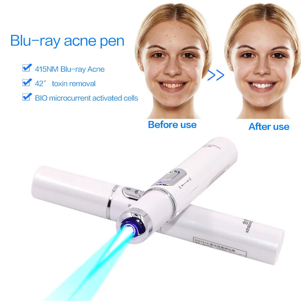 Appareil de beauté à lumière bleue pour le visage, élimination des rides et de l'acné, stylo laser, élimination des taches cutanées, anti-varices, effaceur de veines araignées, traitement médical